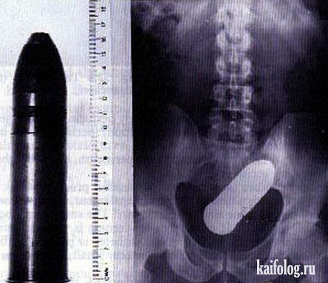 Прикольные рентгеновские снимки (40 фото)