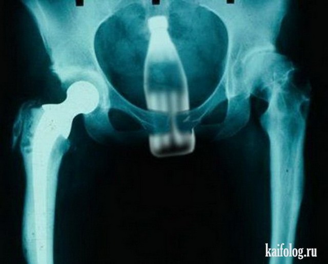 Прикольные рентгеновские снимки (40 фото)